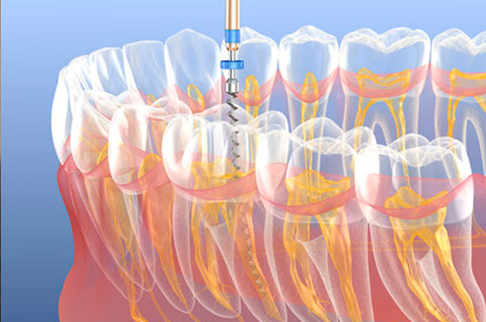 Endodontia